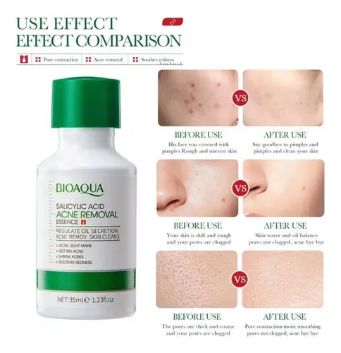 Bioaqua Esencia Antiacné Ácido Salicílico Anti Marcas Poros Acneica Día/noche