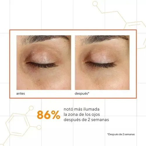 Murad Suero Ojos Vitamina C 15ml Antimanchas Hipoalergénico