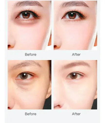2 Parches De Hidrogel Para Ojos Colágeno Anti Ojeras Umi Ls