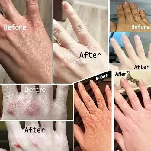 Crema De Ácido Kójico Fade Dull Hbody Fast Smooth M