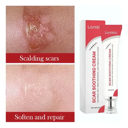 Crema Para Cicatrices Laniska Calmante 30 G Neutra