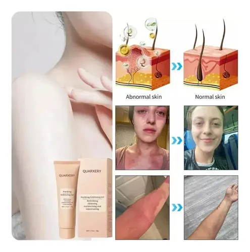 Un Gel Exfoliante Purificador Quarxery, Gel Exfoliante