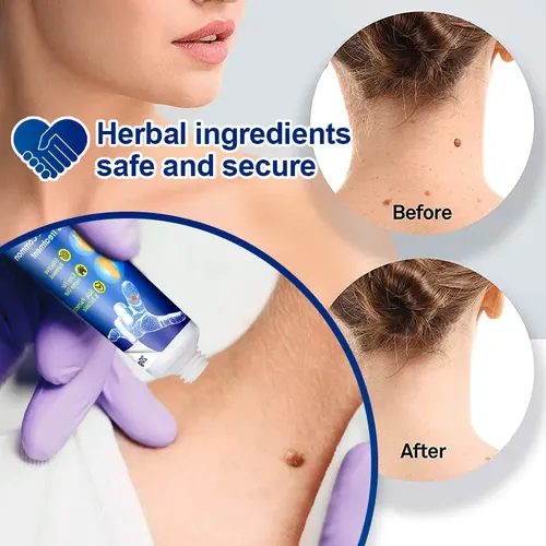 Crema Eliminadora De Manchas Instantánea, 2 Unidades . P&