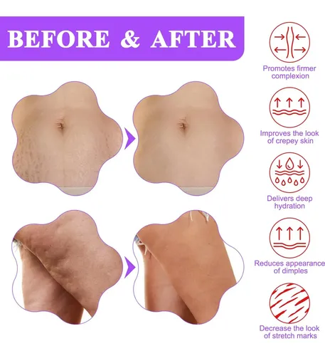 Crema Reafirmante Mynasevo Para Abdomen Y Cuerpo