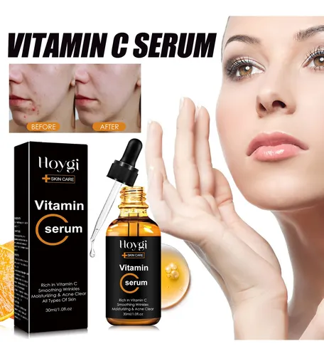 El Sérum De Vitamina C Hoygi Reduce Las Líneas Finas, Las Ar