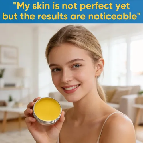 2pcs Acne & Redness Killer, Organics Acne Balm, Remove Skin