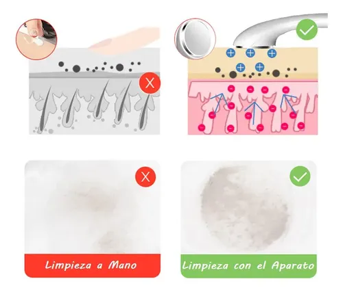 Aparato Facial Limpieza Profunda Blanqueador Exfoliante