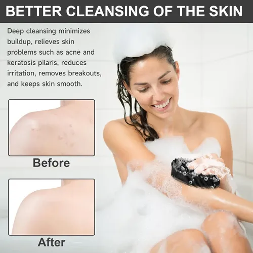 Exfoliante Corporal De Silicona Metene, 4,7 X 2,8 Pulgadas
