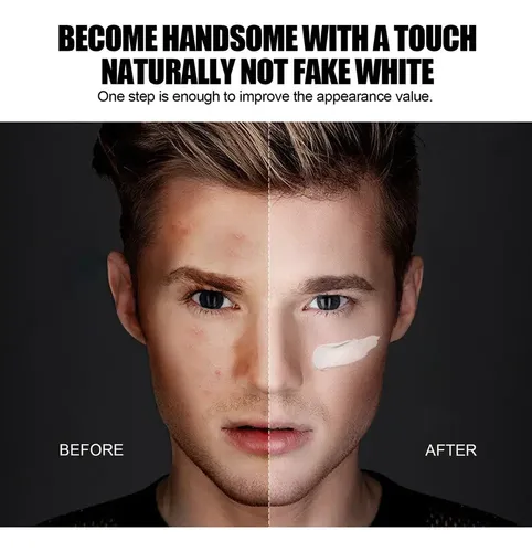 Crema Correctora Para Marcas De Acné Y Defectos