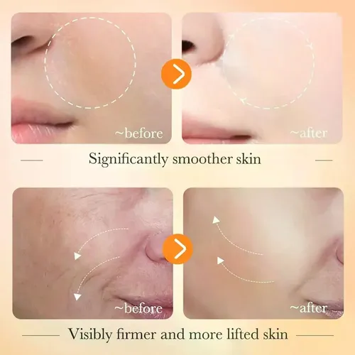 Suero Facial Antioxidante Con Vitamina C 2026 Glow Acne Bioa