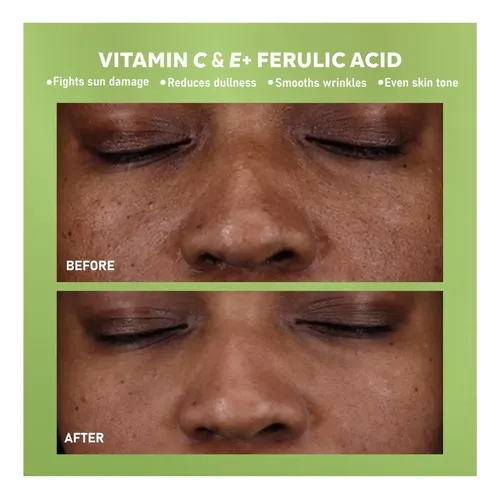 Sero De La Cara Dermadoctor Al 20% De Vitamina C Con E Y | C