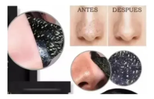 Set Skincare Mascarillas+labios+ojeras+espinillas X10 Un
