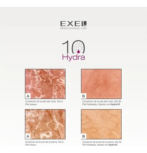 Hydra 10 Exel Piel Extra Seca. Diabetes. Nutritiva Aloe Vera