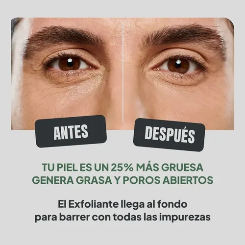 Exfoliante Limpieza Facial Hombres Piel Grasa Umino