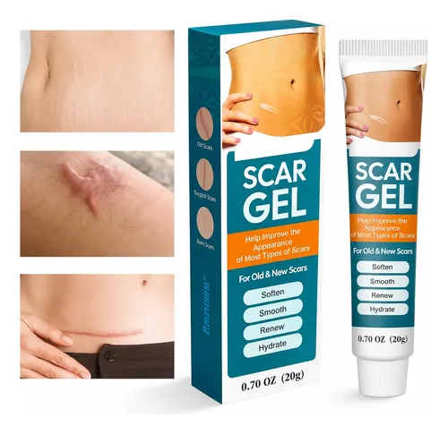 Crema Gel Reparadora Cicatrices Queloide Acne Quemadura Scar