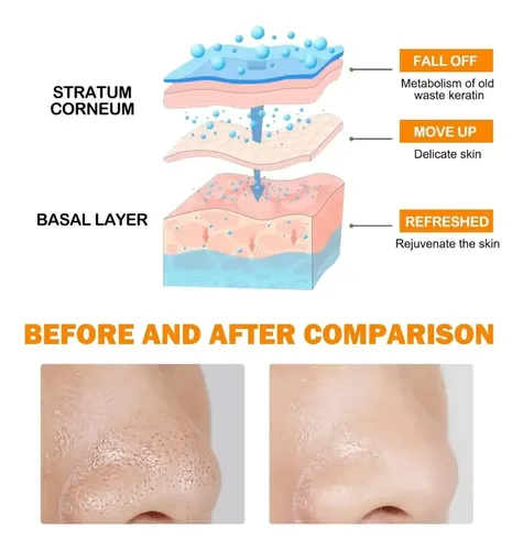 Crema Exfoliante Corporal En Gel De Naranja, 4 Unidades/tarr