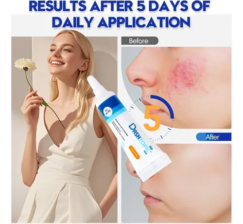 Crema Para Eczema Aim Medical 0.52 Oz