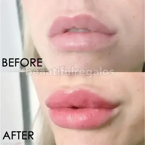 Labial Con Colageno Agrandar Labios Hidratado Maximizador