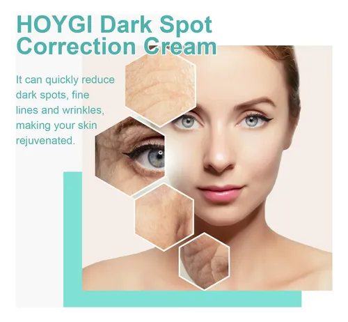 Crema Facial Correctora De Manchas Oscuras Hoygi