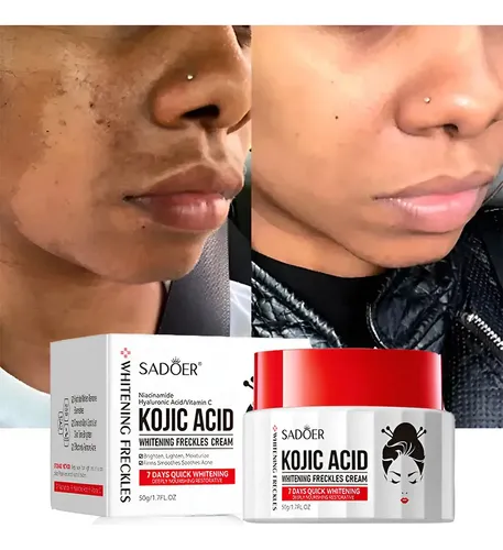 Crema Blanqueadora De Melanina Con Ácido Kójico Que Elimina
