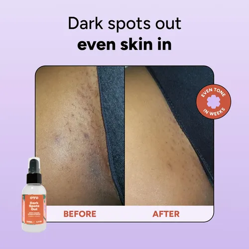 Sérum Para La Piel Oyo 30 Ml Vitamina C + Niacinamida