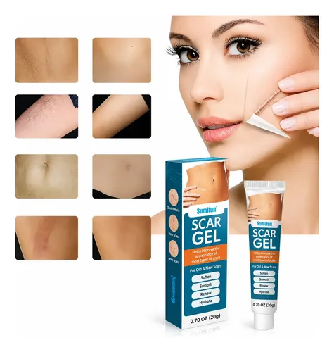 Crema Gel Reparadora Cicatrices Queloide Acne Quemadura Scar