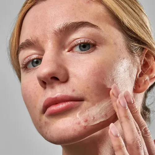 The Inkey List Crema Hidratante Facial Novoretin Antiacné 50ml