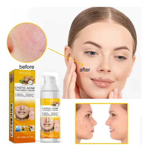 Sérum Facial Eelhoe Para Una Piel Clara Y Minimizar Los Poro