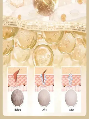 Xt La Crema Oedo Rose De X Skin Care Elimina Las Estrías Y W