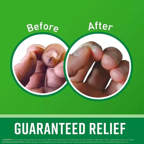 O’Keeffe’s Working Hands 96 g | Crema Reparadora para Manos Secas y Agrietadas, Hipoalergénica y Sin Fragancia, Hidrata Profundamente, Repara Grietas y Restaura la Suavidad Desde el Primer Uso