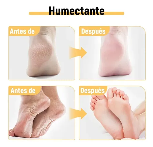Ac Crema Hidratante Y Antiagrietamiento For Pies