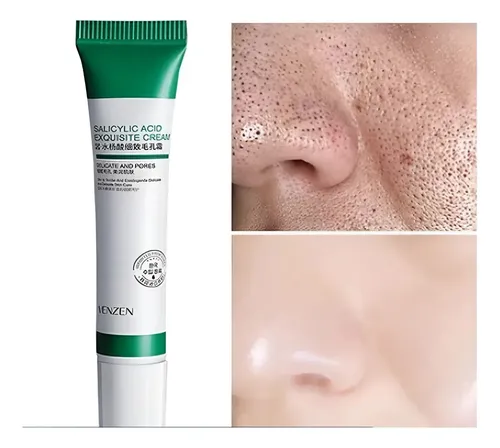 / Crema De Ácido Salicílico Para Eliminar Los Poros Del