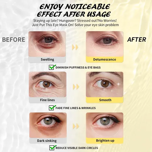Parches Para Ojos Maskiss Con Cafeína 25 Pares Antiojeras