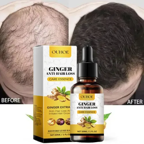 Aceite Esencial De Jengibre Para Cabello, Anticaída, Para El