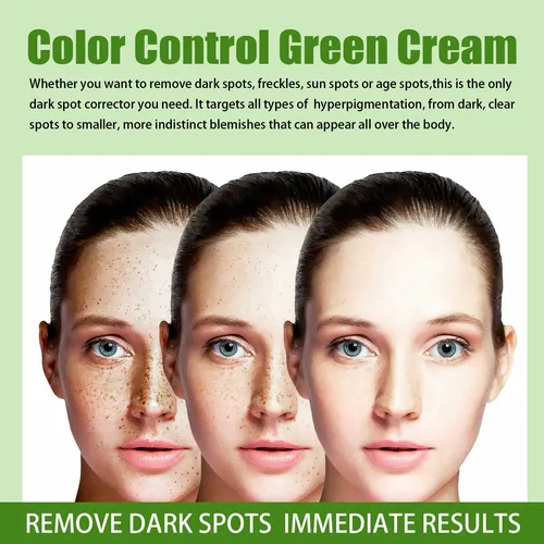 Crema Facial Jaysuing Para Hidratación Y Luminosidad