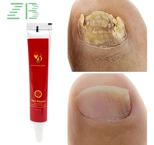 Crema Reparadora De Uñas Generic – Tubo 75ml
