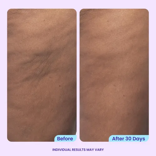 Crema Reafirmante Para Glúteos Y Muslos Gopure – Crema Reafi