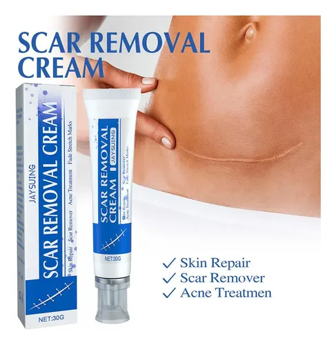 Crema De Eliminación De Cicatrizes%2c Fade Scars Crema R