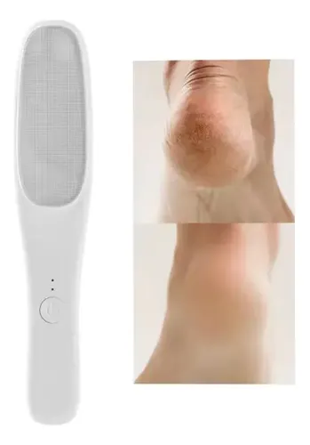 Depiladora Magica Y Exfoliador De Pies 2 En 1 Electrica