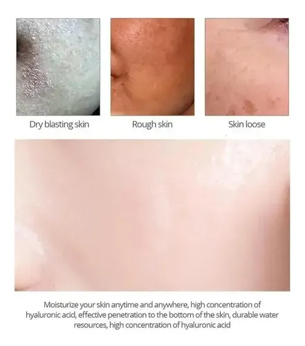 Crema Facial Con Ácido Salicílico 20ml Para Poros