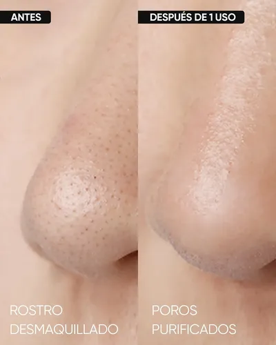 Barra Limpiadora Profunda En Barra Aamáscara Facial De Argil