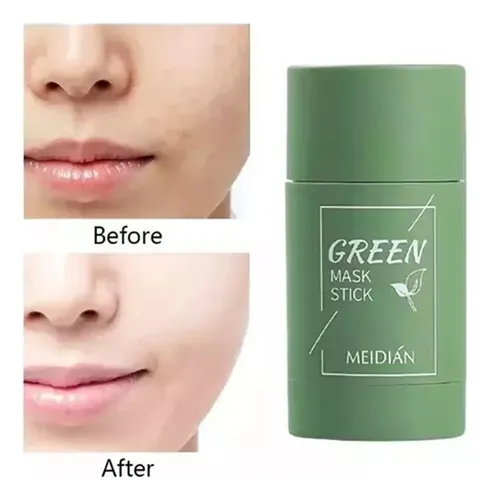 Máscara De Té Verde En Barra, Té Verde, Lista Para El Acné,