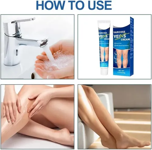 Crema Para Alivio De Varices Piernas Varicosas