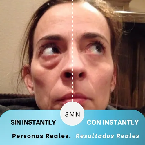 Instantly Ageless – Caja 25 Viales Remueve Arrugas Jeunesse Todo Tipo De Piel Día/noche