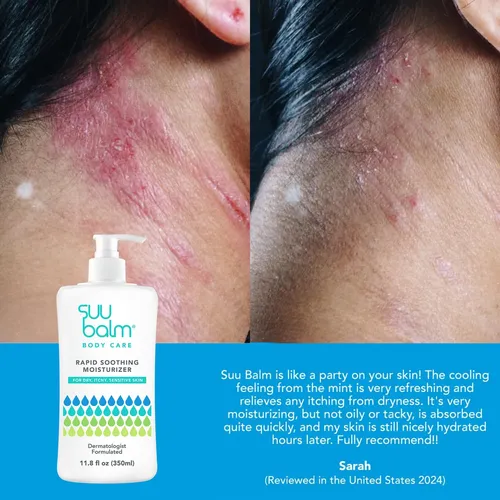 Crema Suu Balm Fast Picazón Alivio Rápido De 350 Ml Para Pie