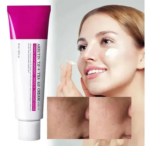 A Crema De Arbutina, 7% De Ácido Tranexámico, 4%, Crema De