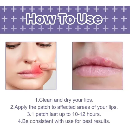 Tn 3 Parches Útiles For Aliviar El Herpes Labial Y Curar