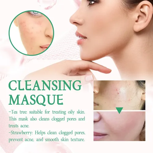Mascarilla En Barra Hoygi Strawberry Clay Para Limpieza Prof