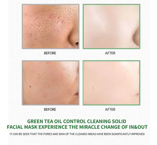 Mascarilla Removedora De Puntos Negros Creative Green Para R