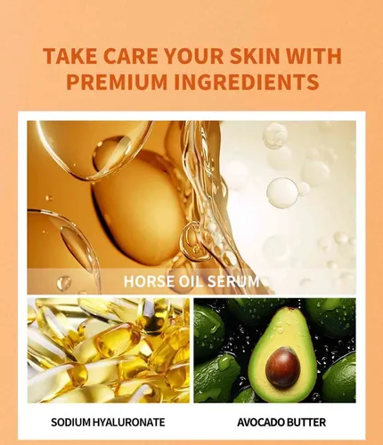La Crema Antipecas Para Manos Restaura La Piel, Hidrata Y Pr